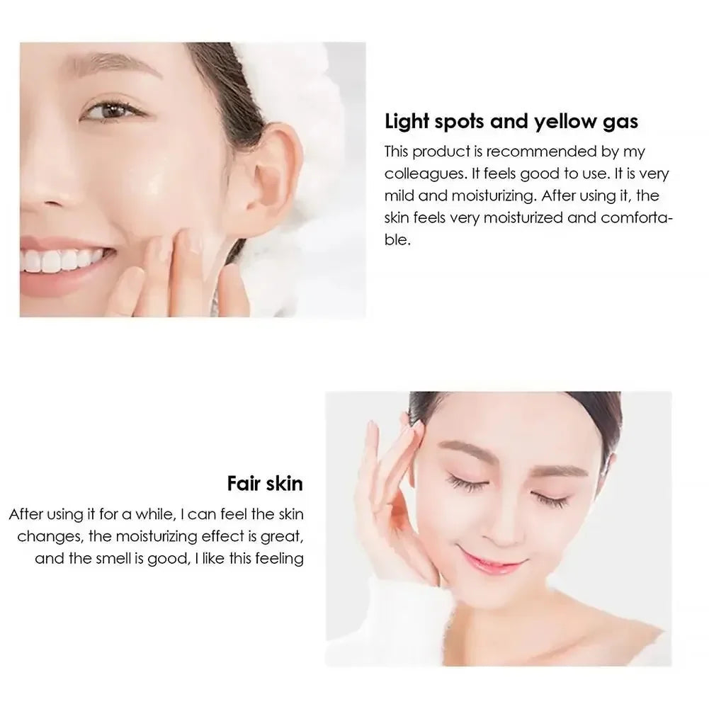 Brightening Niacinamide Whitening Cream – Anti-Freckle & Dark Spot Peaceful Pleasures Health and Wellness