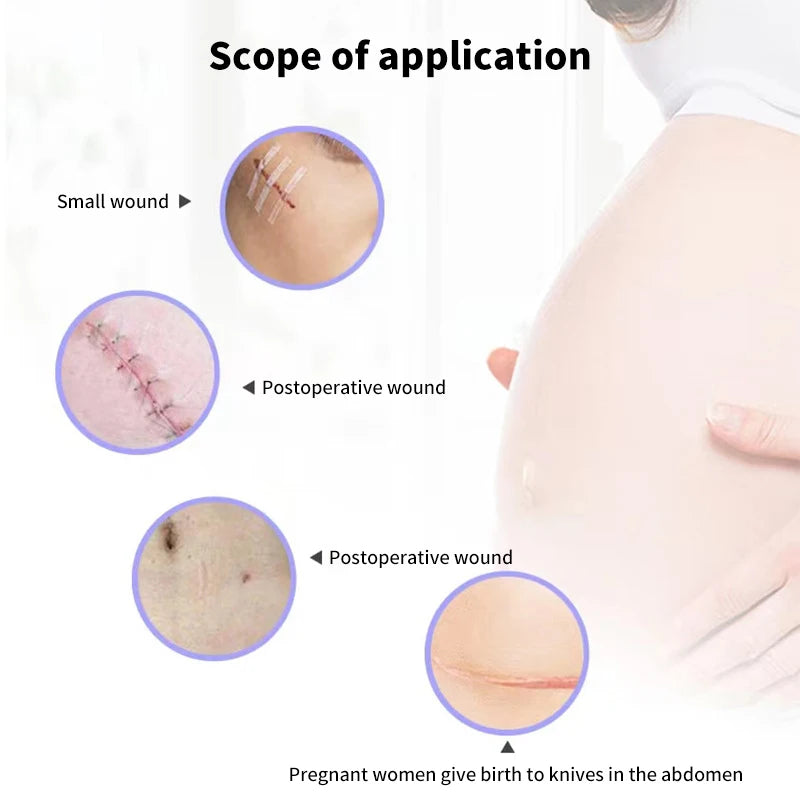 5 Strips Wound Skin Closure Strips Postpartum Wound Repair Cosmetic Surgery Strip Adhesive Medical Suture Free Surgical Tape Peaceful Pleasures Health and Wellness