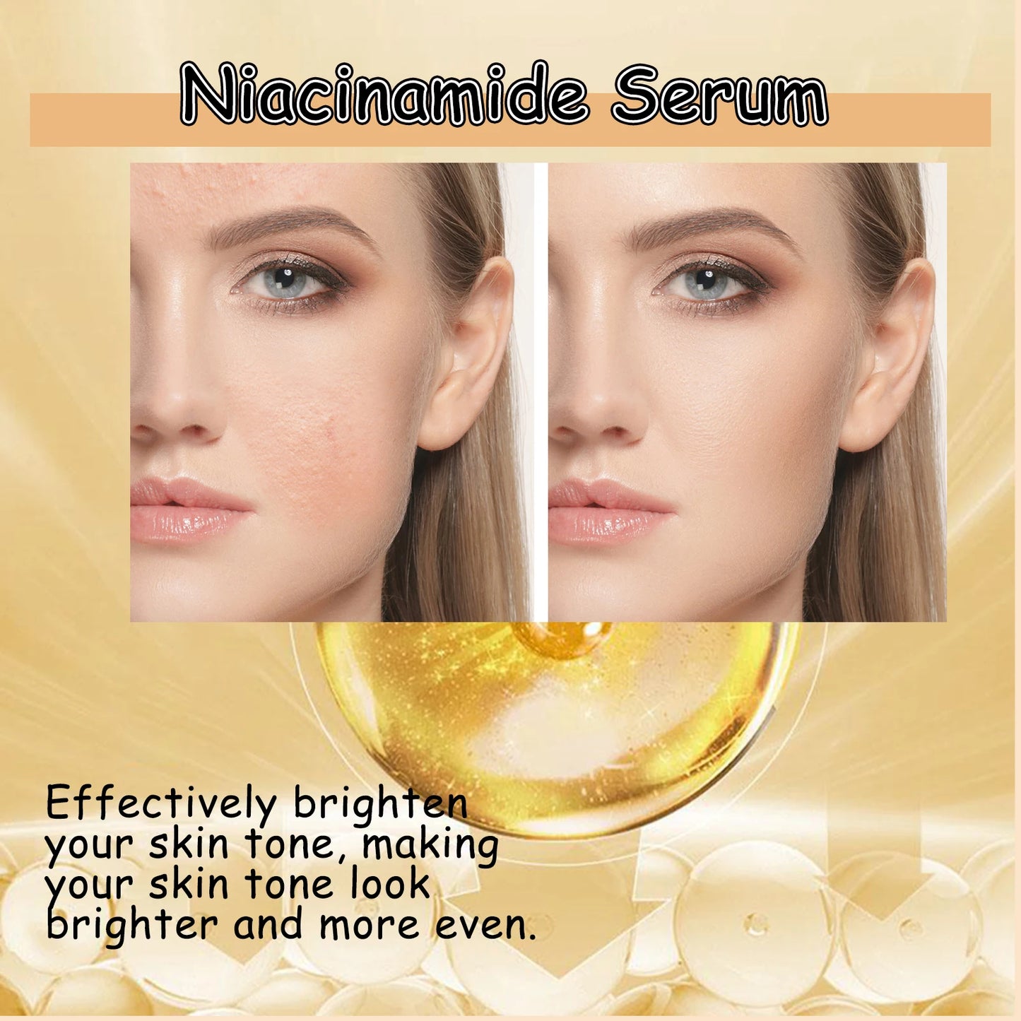 Niacinamide Serum for Dark Spots, Brightening & Oil Control