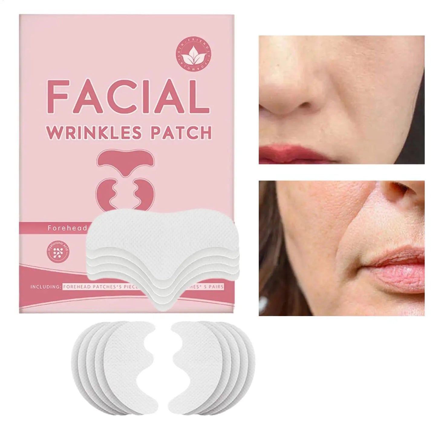 Forehead & Smile Line Lifting Patches – Anti-Wrinkle 10pc Set