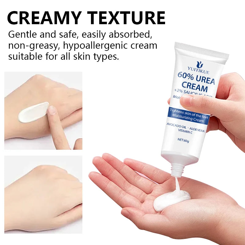 YUITIKUE 60% Urea Foot Cream – Salicylic Acid & Vitamin C 60g