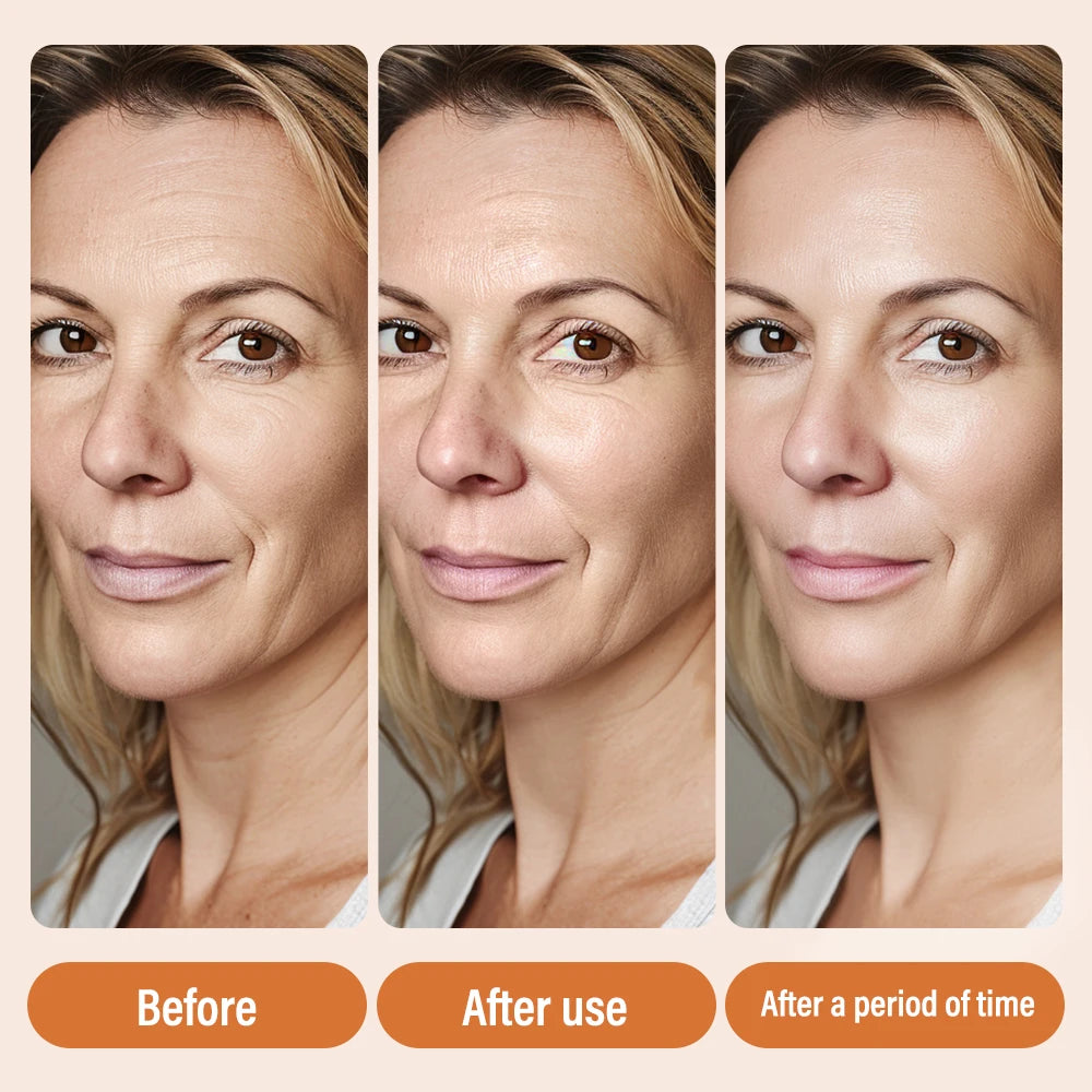 Super Vitamin C Serum for Face Dark Spot Remover for Face Skin Care Hyaluronic Acid Serum Targets Age Spots Hydrates and Wrinkle Peaceful Pleasures Health and Wellness