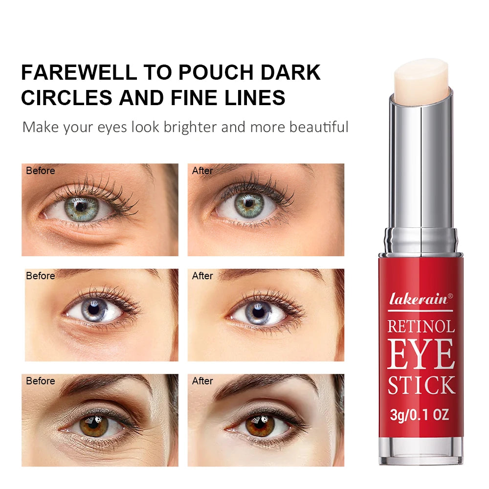 Retinol Eye Cream Lightening Dark Circles Firming Skin Instant Eye Repair Serum Stick for women Women Eyes Care Peaceful Pleasures Health and Wellness