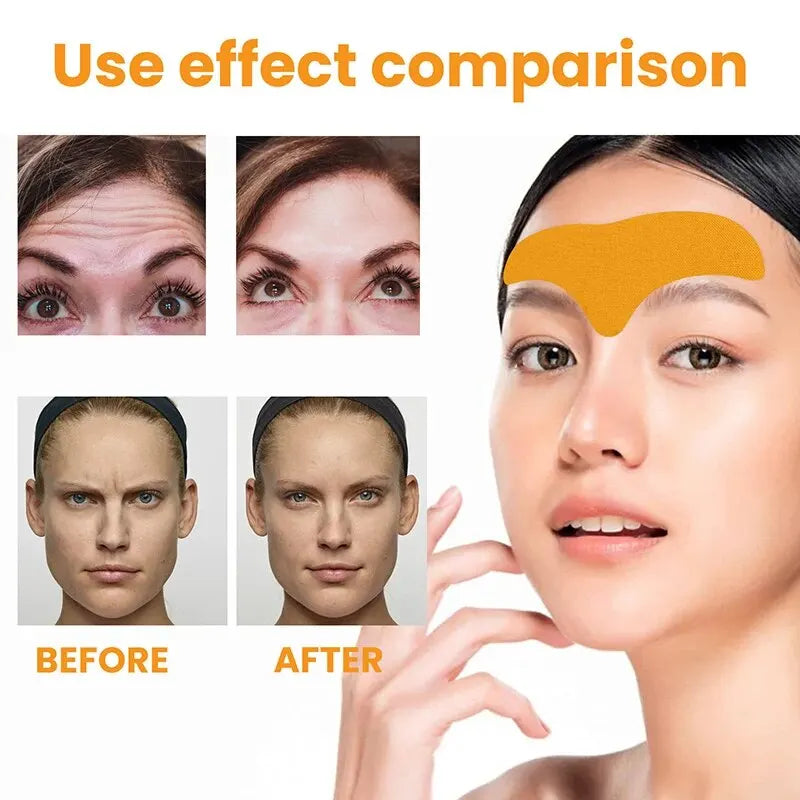 The Forehead Wrinkle Patch Can Lift The Face And Tighten The Skin The Forehead Patch Can Fade And Smooth The Forehead Wrinkles Peaceful Pleasures Health and Wellness