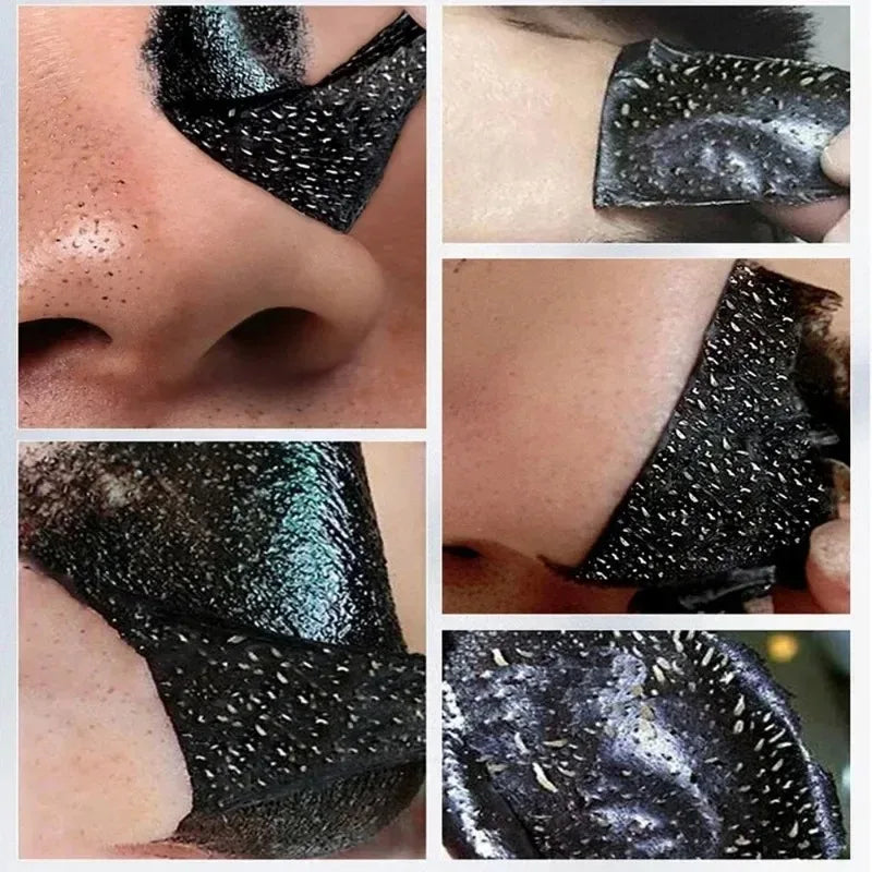 LANBENA Blackhead Remover Peel Mask – Deep Pore Cleansing