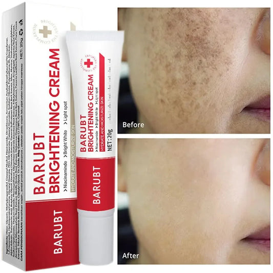 Brightening Face Cream – Dark Spot Corrector & Pigmentation Brightening Face Cream Oasis Select Default Title