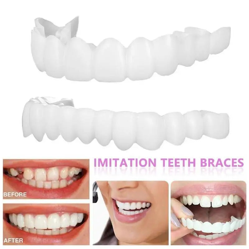 Snap-On Teeth Veneers – Reusable Smile Cover for Men & Women