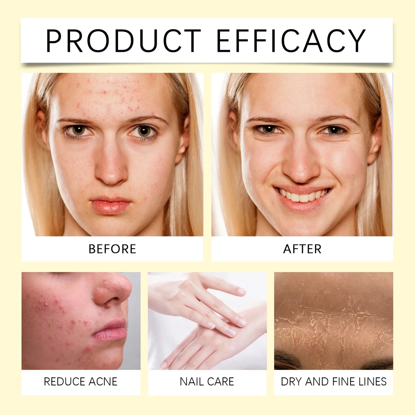 WOODSLEEP Vitamin E Dry Oil – Face, Body, Hair & Nails 60ml