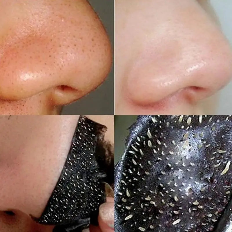 Blackhead Remover Peel Mask – Deep Cleanse & Pore Minimizer