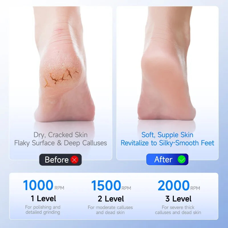 Electric Foot File & Callus Remover – Rechargeable Pedicure Tool Electric Callus Remover Peaceful Pleasures Health and Wellness