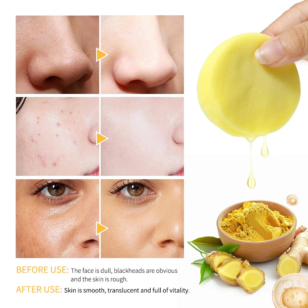 80pc Turmeric Kojic Acid Cleansing Pads | Brighten & Exfoliate Exfoliating Cleansing Pads Peaceful Pleasures Health and Wellness