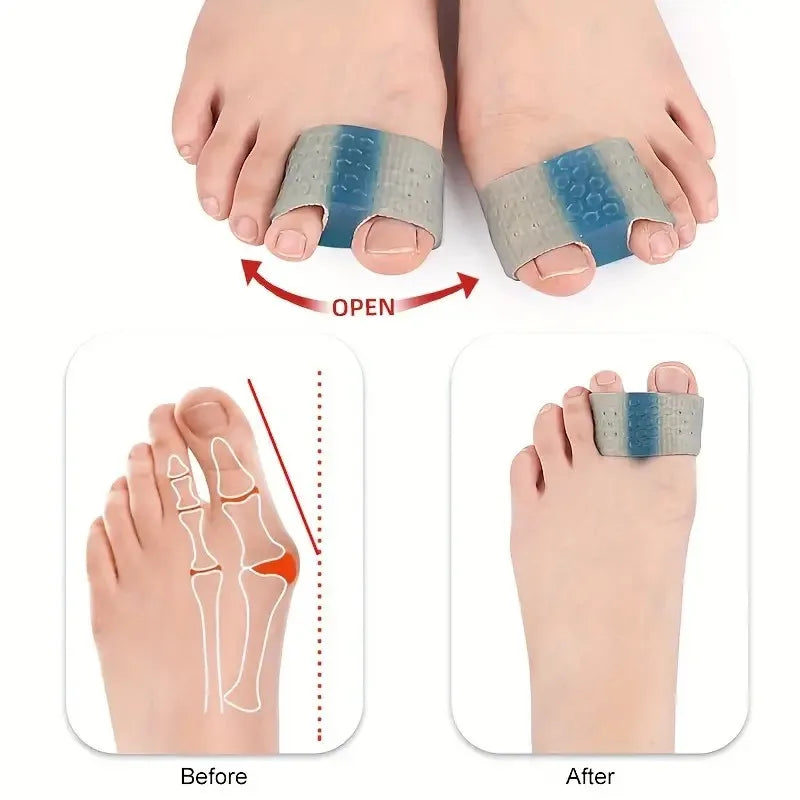 1PC Double Toe Separator, Hallux Valgus Overlapping Toe Separator, Male And Female Fiber Double Hole Toe Orthosis Cuttable Peaceful Pleasures Health and Wellness