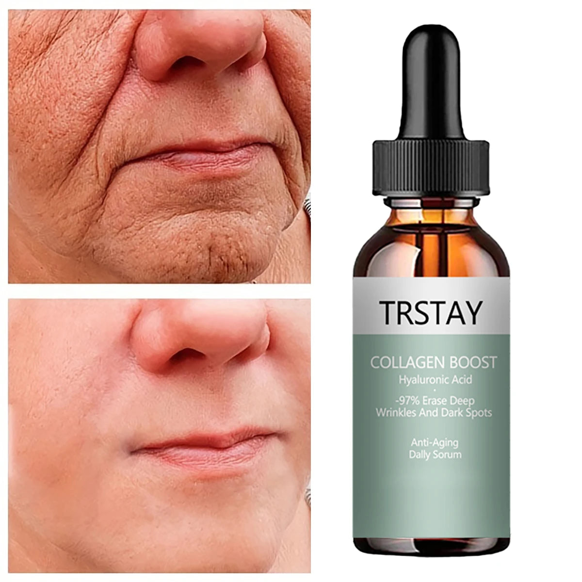 Facial Anti Wrinkle Serum Dark Spot Remover For Face Lifting Firming Essence Fade Fine Line Moisturizing Whitening Care Products Peaceful Pleasures Health and Wellness 30ml