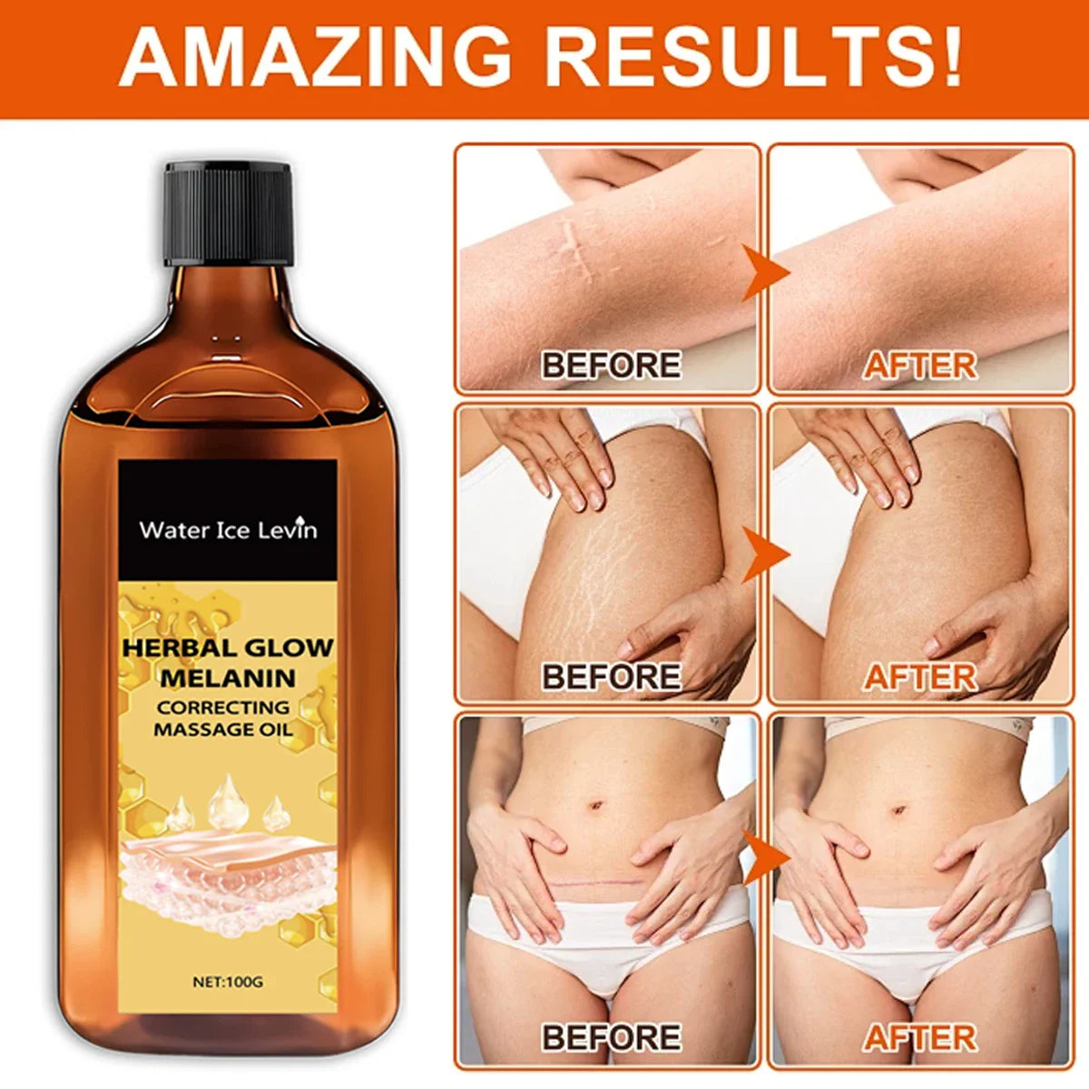 Herbal Glow Melanin Correcting Oil – Bee Venom & Vitamin C