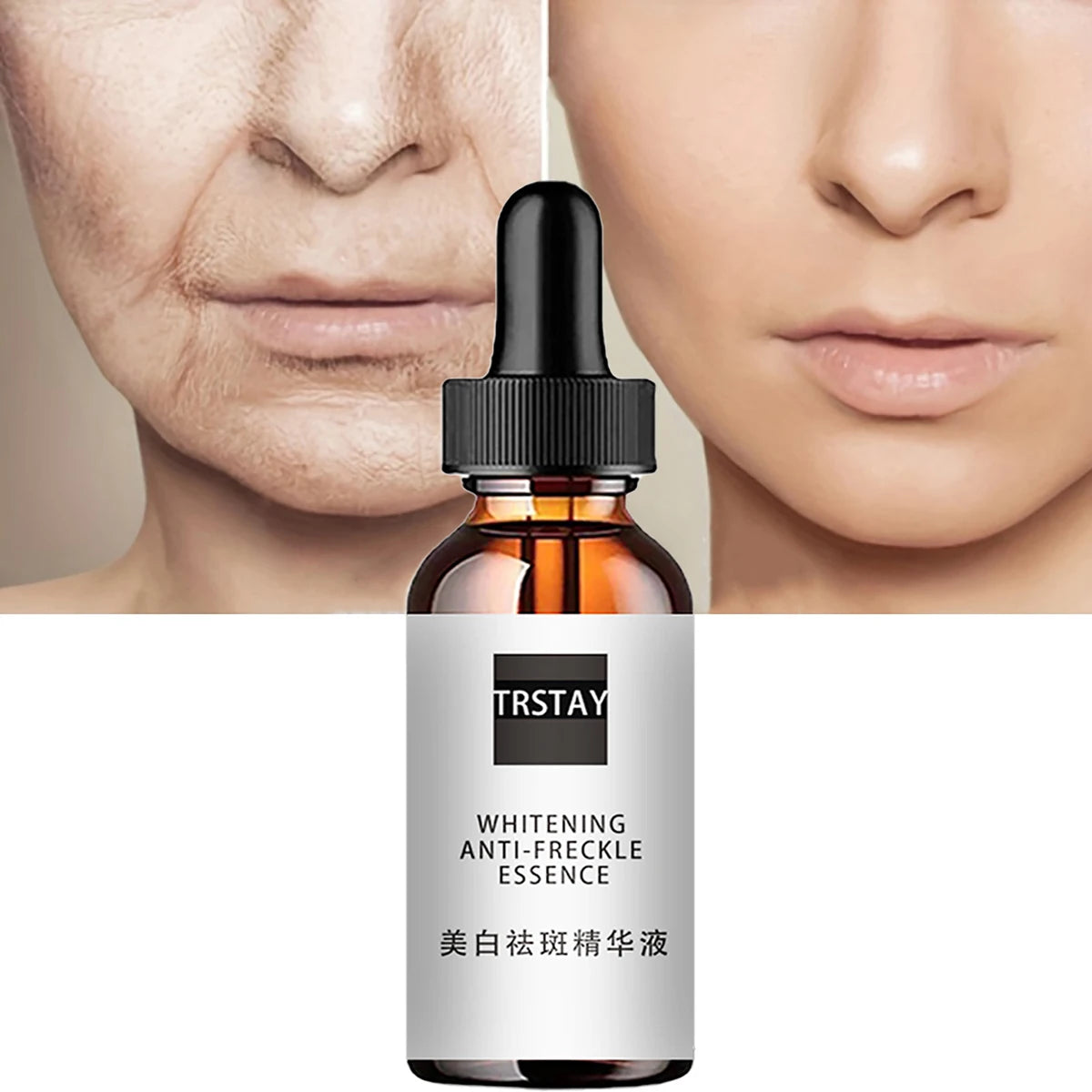 Niacinamide Acid Facial Essences Deep Moisturizing Niacinamide Acid Face Serums Niacinamide Facial Toner Essence Shrink Pores Peaceful Pleasures Health and Wellness