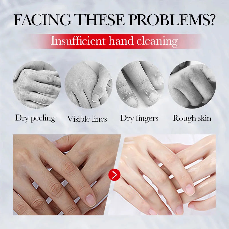 SADOER Kojic Acid Hand Cream Moisturizing Nourishing Brightening Hydrating Hand Creams Beauty Hands Skin Care Products Peaceful Pleasures Health and Wellness