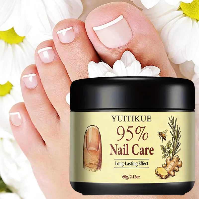 Yuitikue 95% Nail Care Cream, 60g Long-Lasting Nail Repair Cream for Strengthening Nails & Improving Nail Health Peaceful Pleasures Health and Wellness