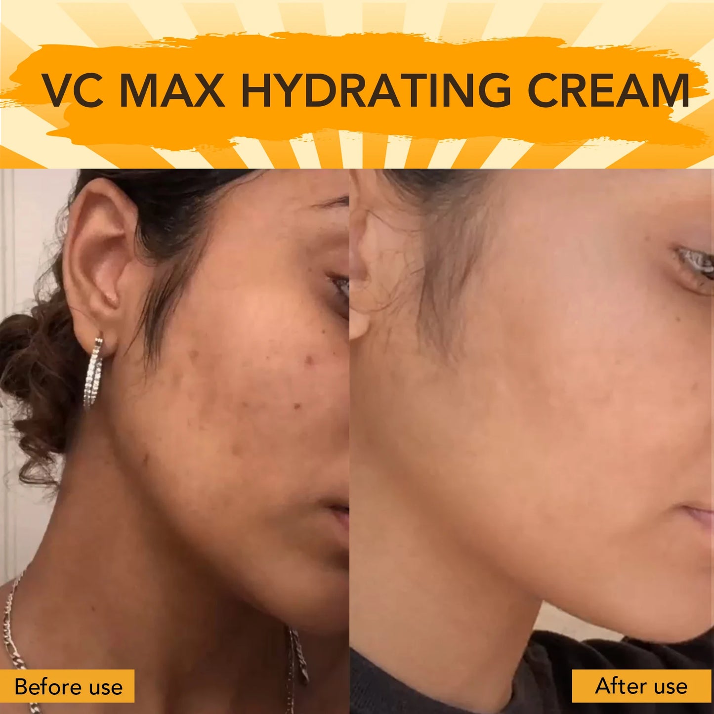 AILKE Vitamin C Brightening Face Cream with Collagen | 100ml
