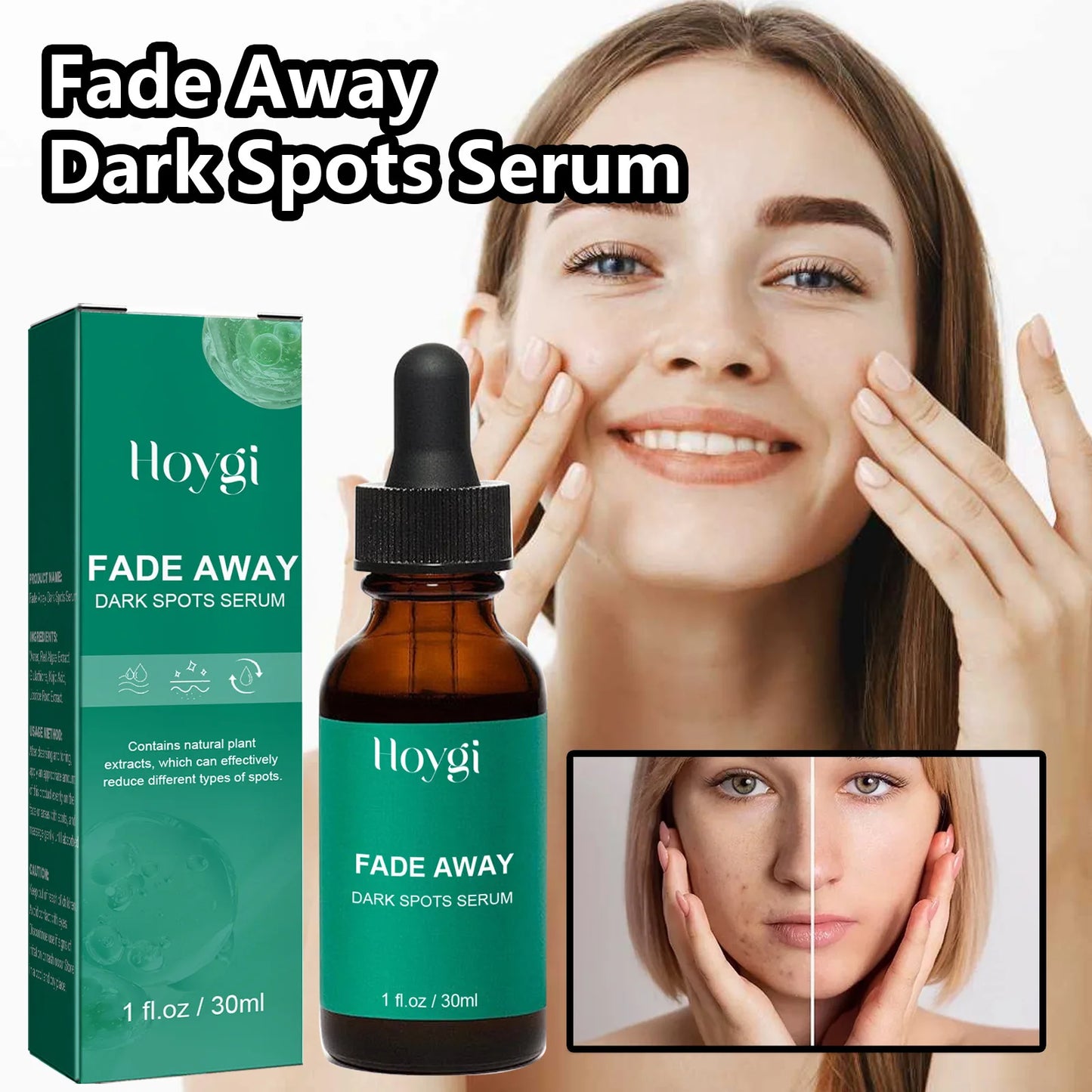 Dark Spots Treatment Serum Fade Acne Marks Remove Melasma Anti Pigmentation Whitening Freckle Nourishing Pores Shrinking Essence Peaceful Pleasures Health and Wellness