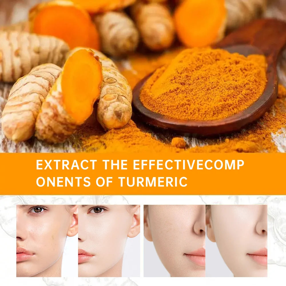 LGRAMER Turmeric Serum – Fade Dark Spots & Brighten Skin