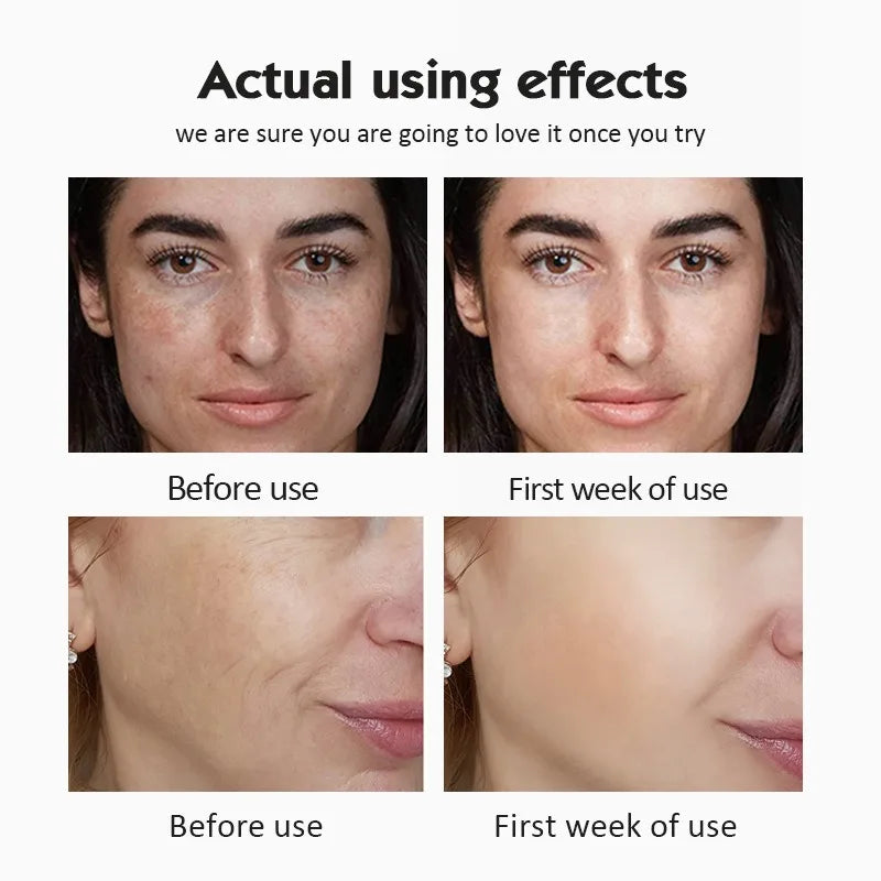 Before and after effects of a skincare product on a woman's face.