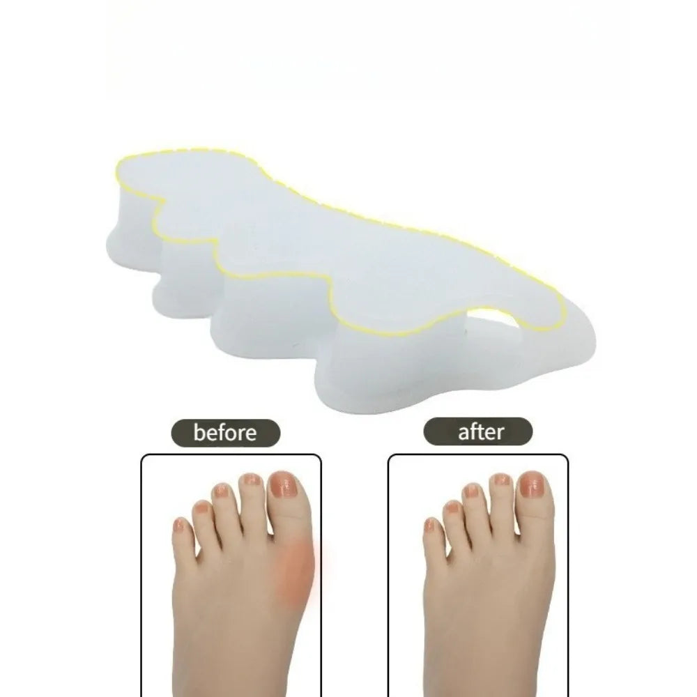 2pcs=1pair Protective Toes Separator Suitable Bunion Corrector Material Soft Gel Straightener Spacers Care Tool Small Easy Carry Peaceful Pleasures Health and Wellness