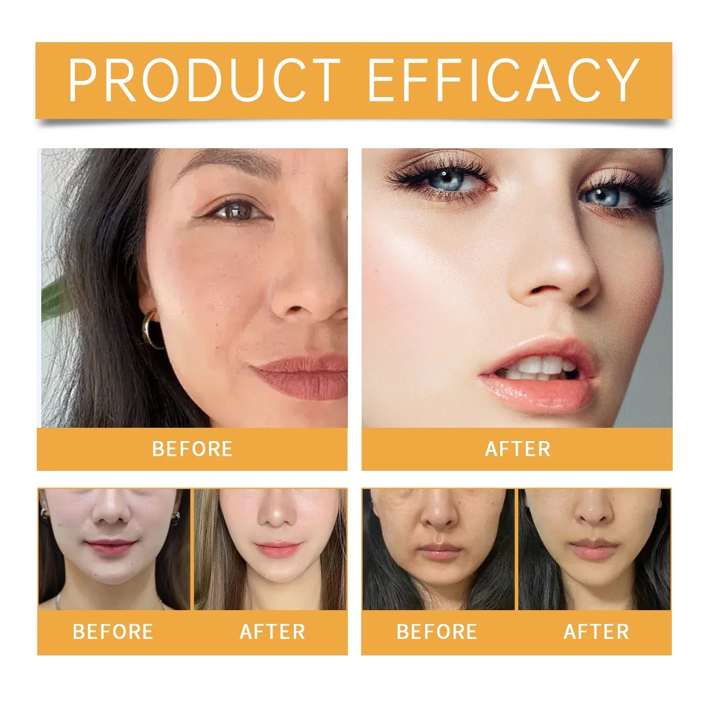 Nasolabial Folds Patch – Collagen & Hyaluronic Acid Firming Mask