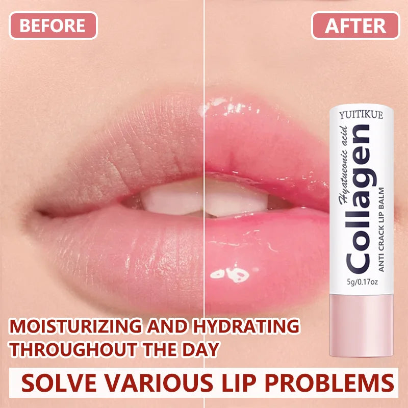 Collagen & Hyaluronic Acid Lip Balm – 24H Hydration | 5g