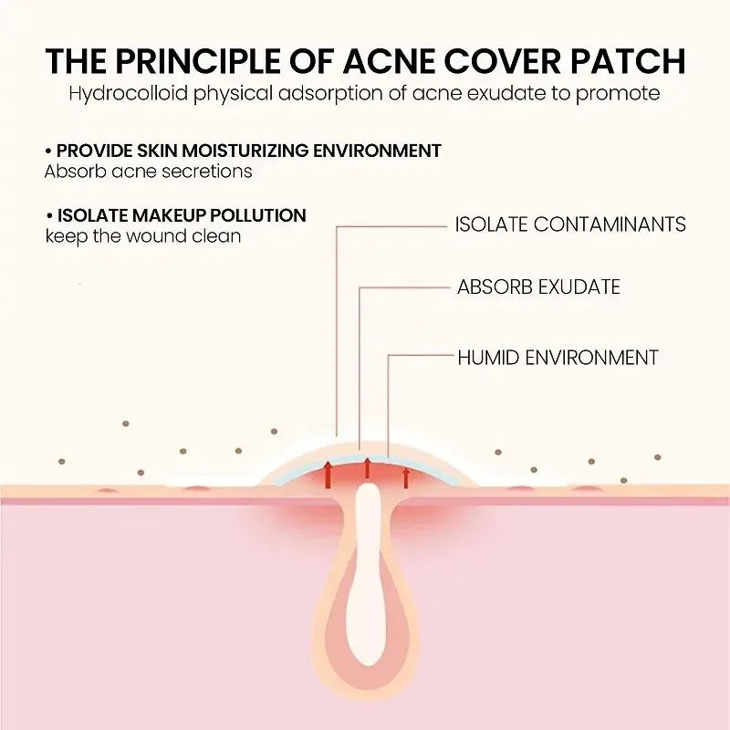200pcs Acne Pimple Repair Patches | Fade Blemishes & Cover Spots