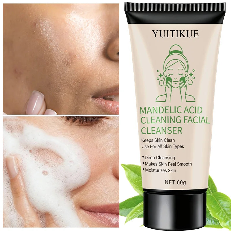 YUITIKUE Facial Cleanser 60g - Mandelic Acid Formula, Gentle Deep Cleansing, Moisturizes & Controls Oil Peaceful Pleasures Health and Wellness