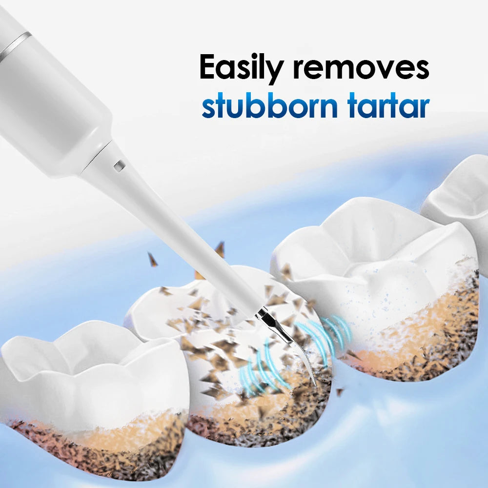 Electric Teeth Cleaner Remove Tartar Plaque Calculus and Tooth Stains Dental Teeth Whitening Kits With 6 Toothbrush Heads Home Peaceful Pleasures Health and Wellness
