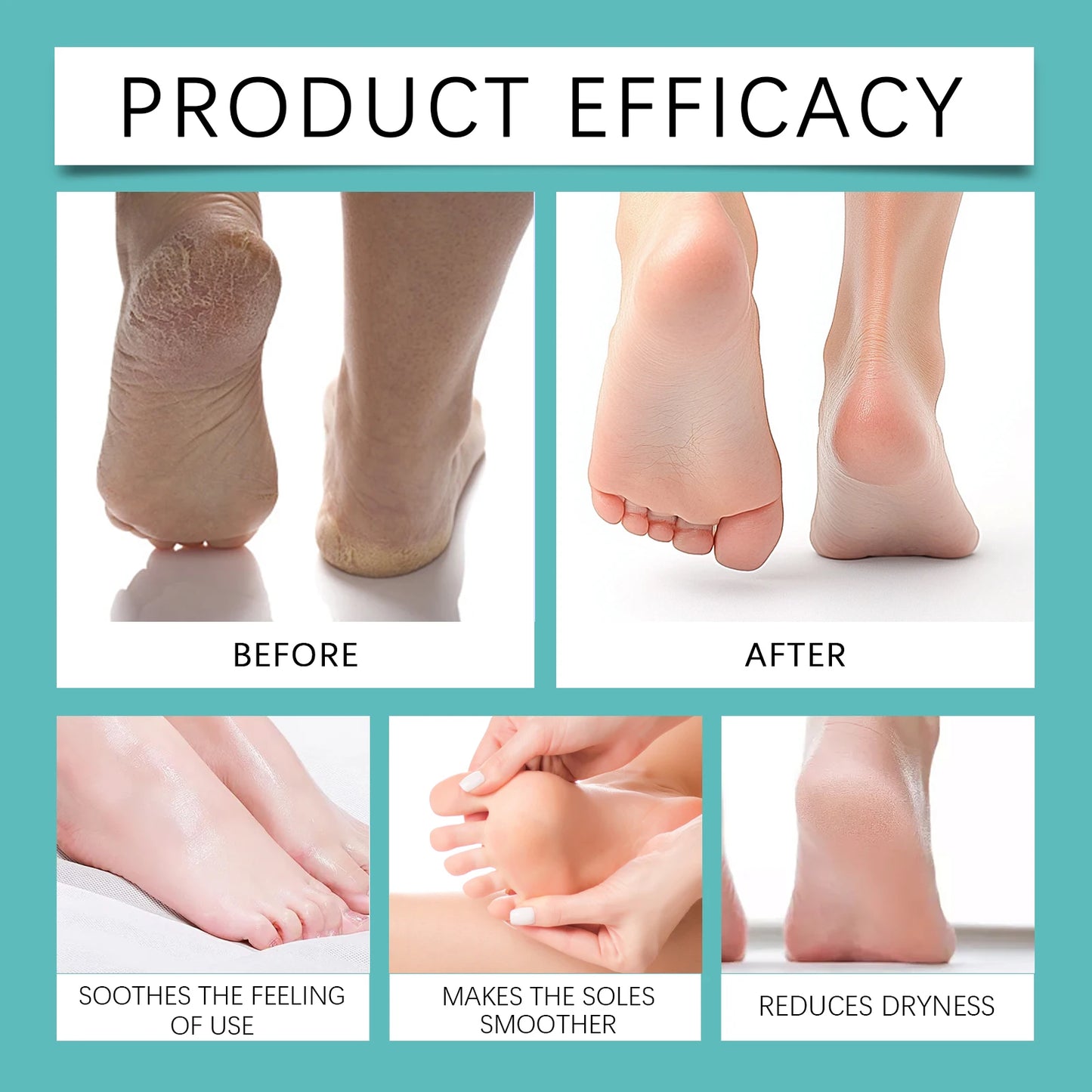 South Moon Foot Peeling Spray | Exfoliate & Soften Feet 20ml