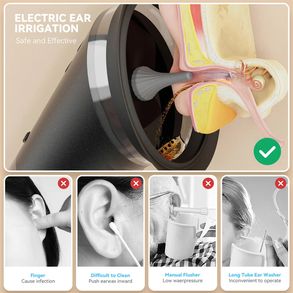 Electric Ear Wax Removal System Water Powered Ear Cleaning Tool with Irrigation Flusher 3 Pressure Settings Safe & Effective Peaceful Pleasures Health and Wellness