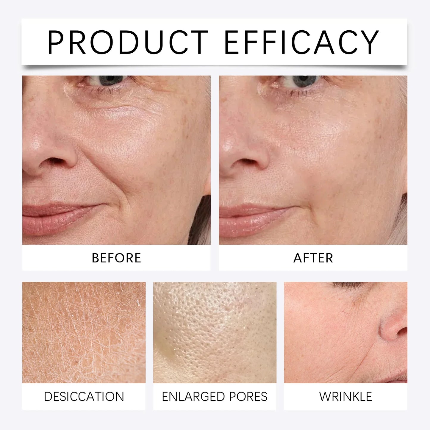 Eelhoe Anti-Aging Firming Serum Kit with Microneedle Roller