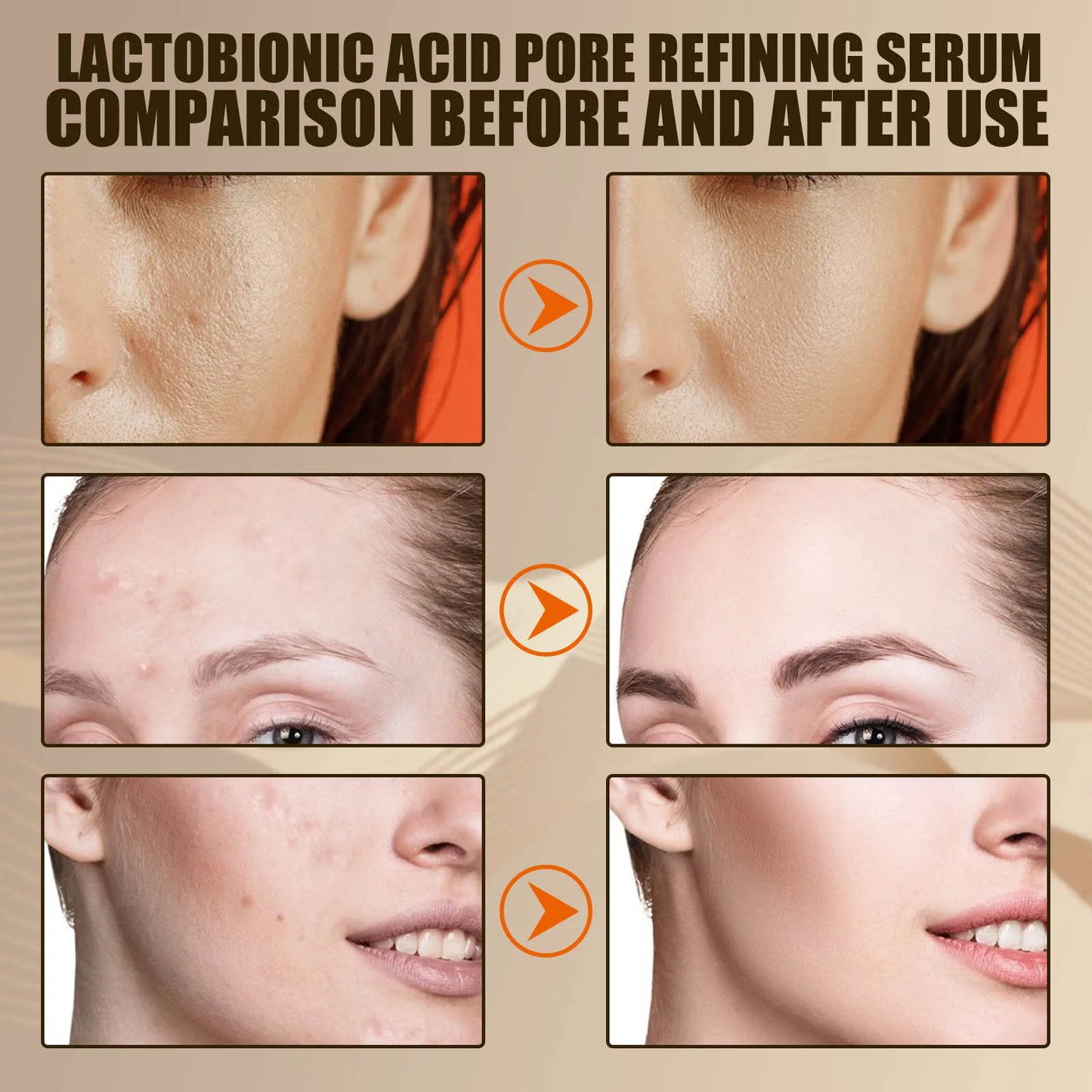 Lactic Acid Pore Shrinking Serum – Blackhead & Brightening 30ml