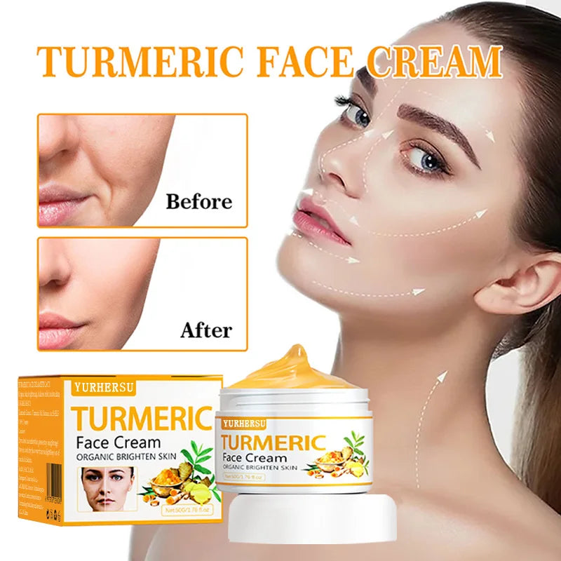 YURHERSU Turmeric Brightening Face Cream 50ml | Dark Spots