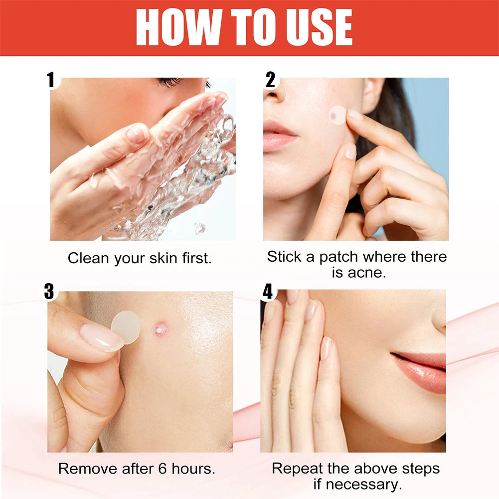 200pcs Star Acne Pimple Patches Colorful Breathable Removal Pimple Absorb Secretions Anti Infection Concealer Makeup Skin Care Peaceful Pleasures Health and Wellness