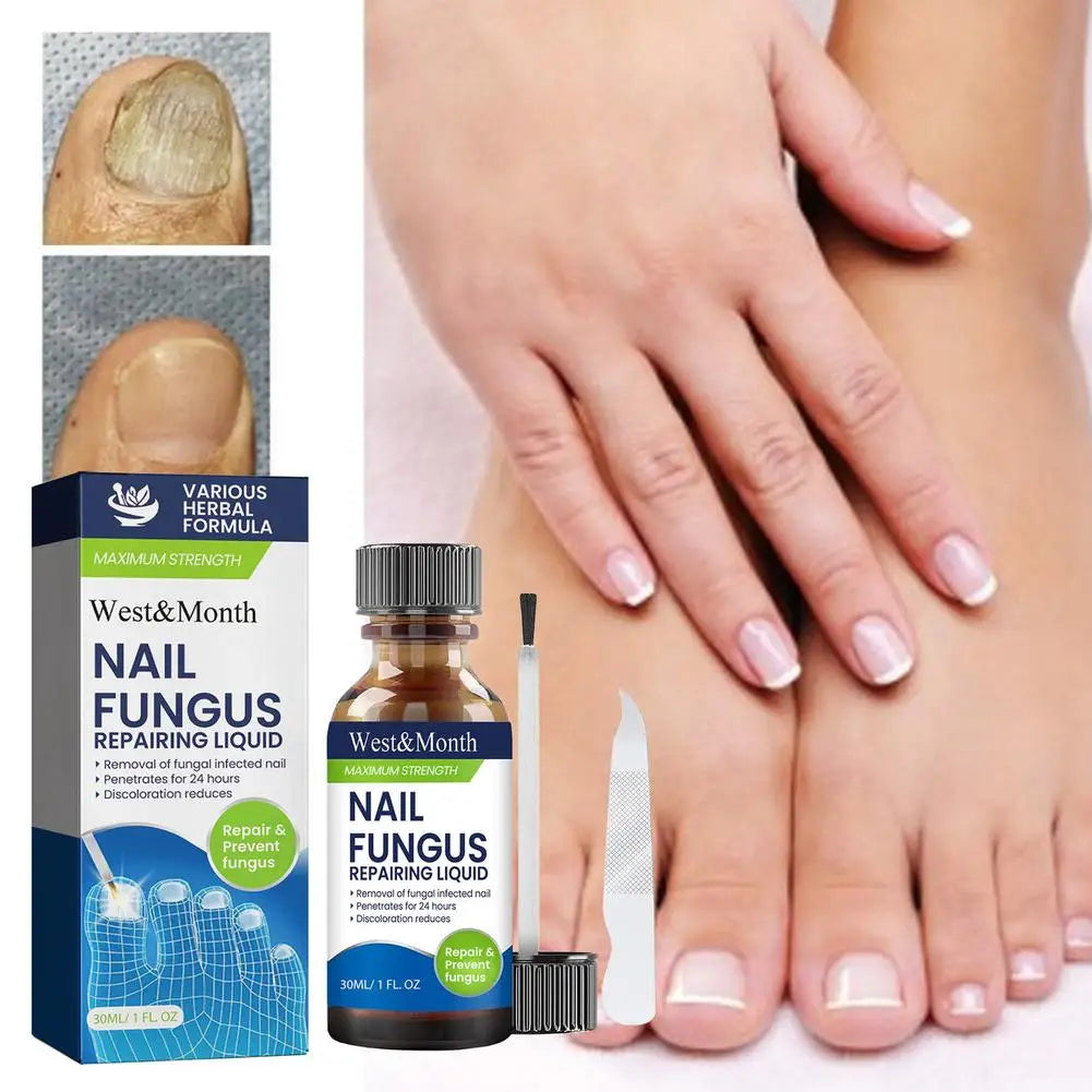 7-Day Nail Repair Serum & Nail Care Essence Oil Nail Repair Serum Peaceful Pleasures Health and Wellness