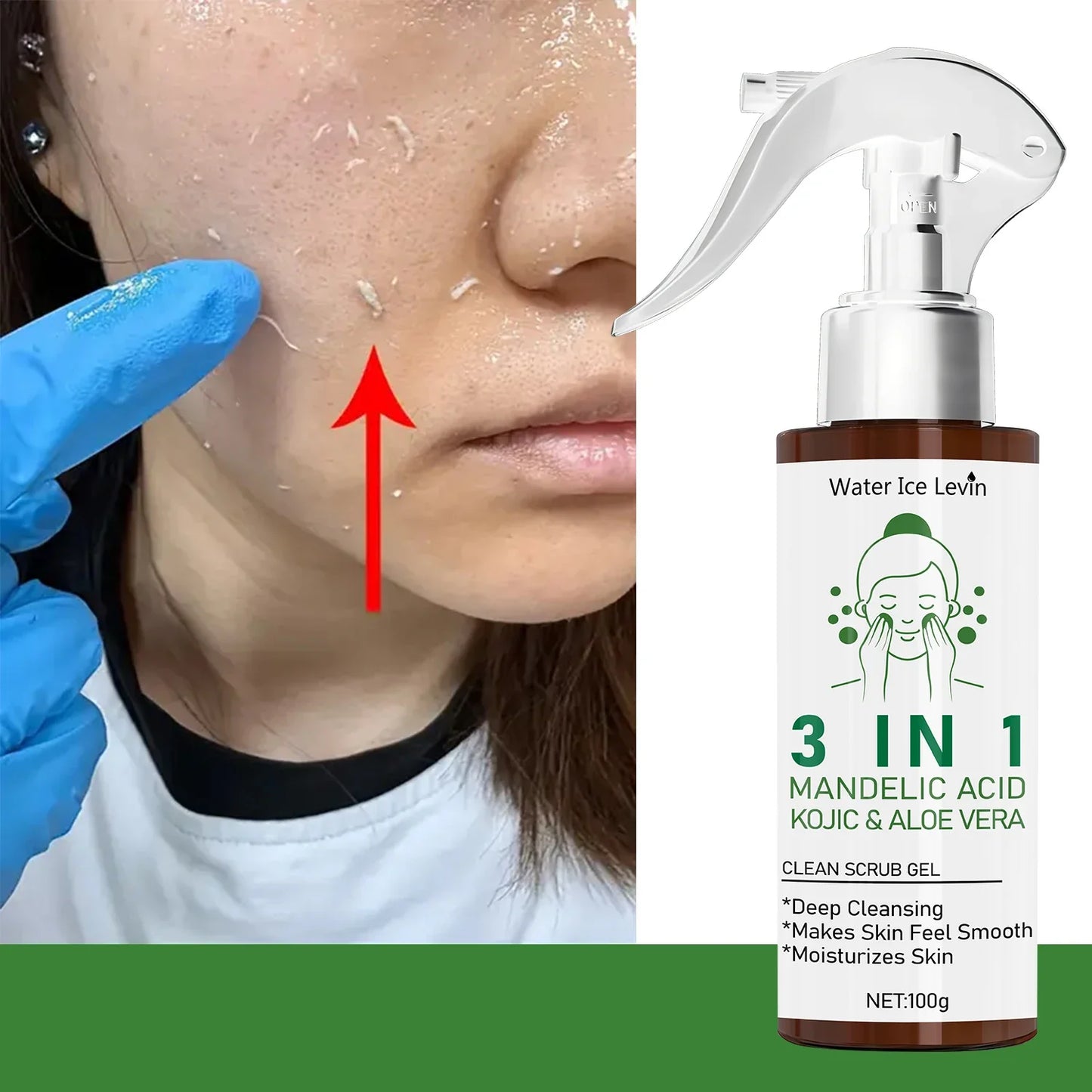 3-in-1 Mandelic Acid & Kojic Scrub Gel with Aloe Vera 100g