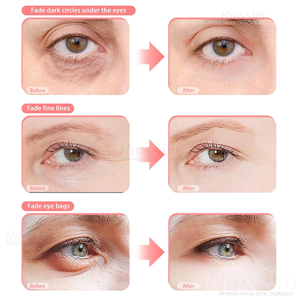 Eye Massager 3D Red Light EMS Eyes Relax Massager Fatigue Relief Lighten Dark Circles Smooth Eye Fine Line Beauty Eye CareDevice Peaceful Pleasures Health and Wellness