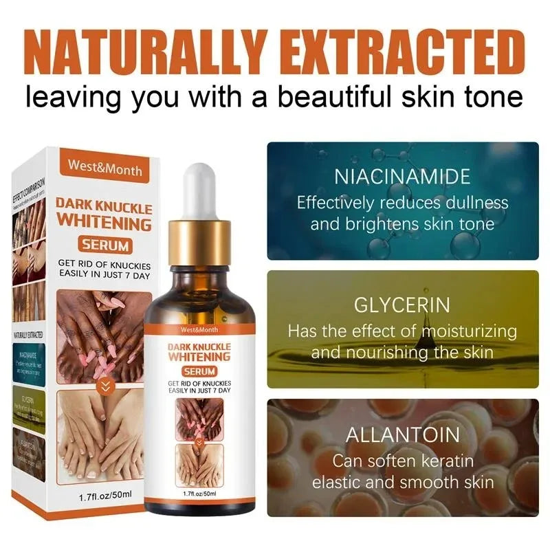 Dark Knuckles Whitening Serum Remover Get Rid of Dark Knees Dark Knuckle Elbow Cream Moisturizing Brighten Skin Tone Care Peaceful Pleasures Health and Wellness