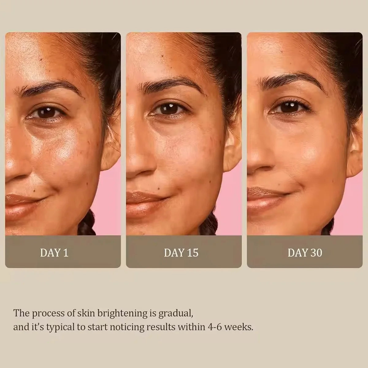 Turmeric Kojic Acid Brightening Soap 100g | Glow & Acne Care