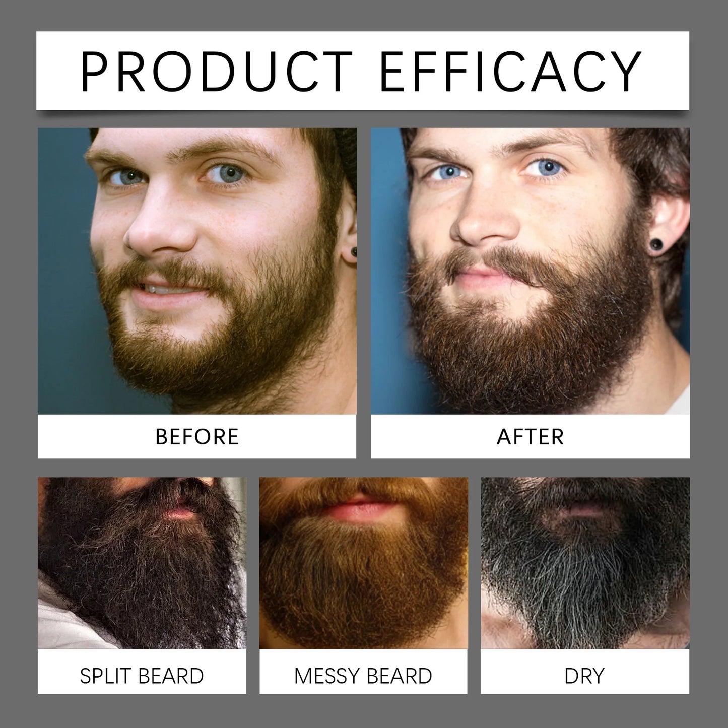 East Moon Beard Growth Serum Set | Thicker, Softer Beard Care