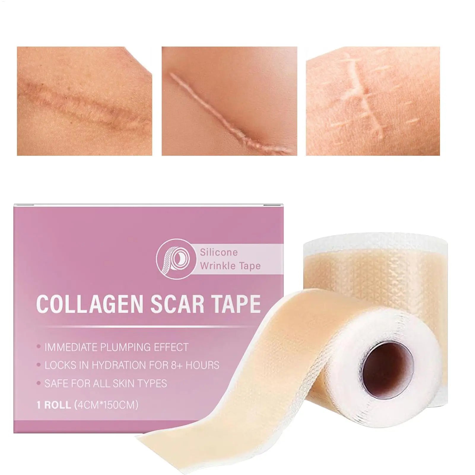 Scar Sheets 1 Roll Self-Adhesive Scar Cover Tape Skin Care Waterproof and Breathable Peaceful Pleasures Health and Wellness