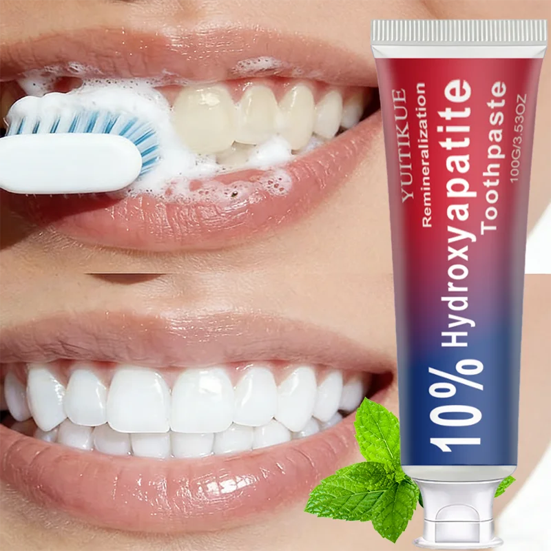 Yuitikue 10% Hydroxyapatite Toothpaste, Remineralizing Teeth Whitening Paste for Deep Cleaning & Oral Care, 100g Peaceful Pleasures Health and Wellness