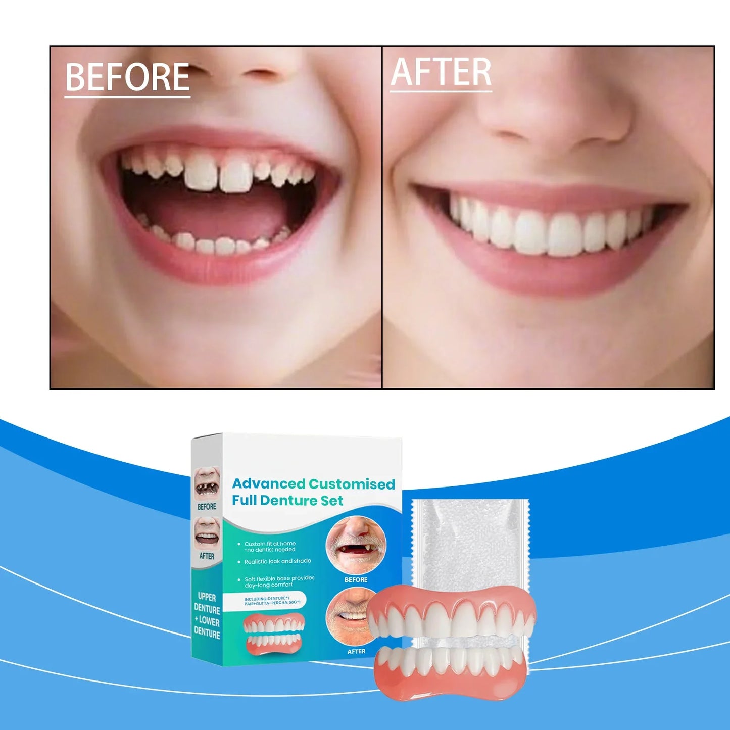 Adjustable Cosmetic Teeth Veneer Set – Smile Cover Kit