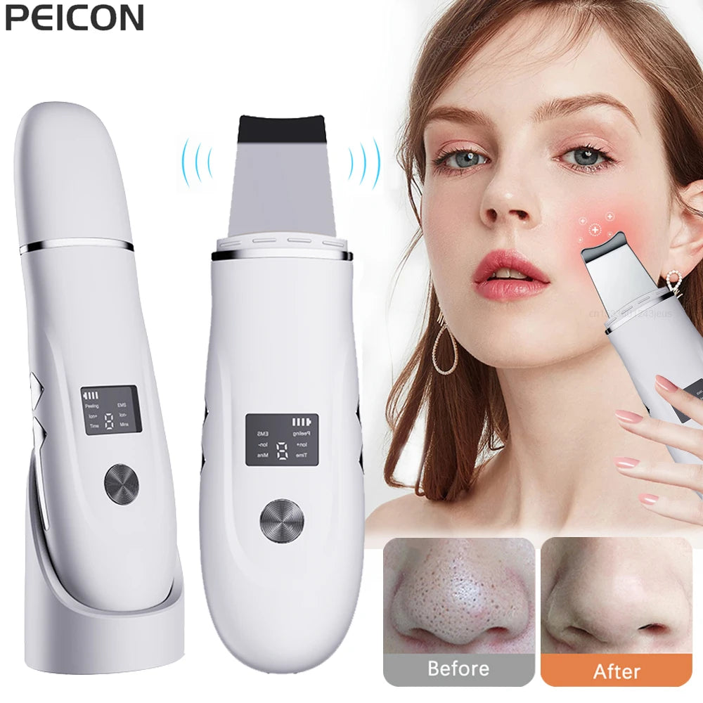 Ultrasonic Face Scrubber Facial Peeling Skin Scrubber Deep Facial Cleaning Spatula Acne Pore Ultrasonic Scrubber Facial Cleanser Peaceful Pleasures Health and Wellness