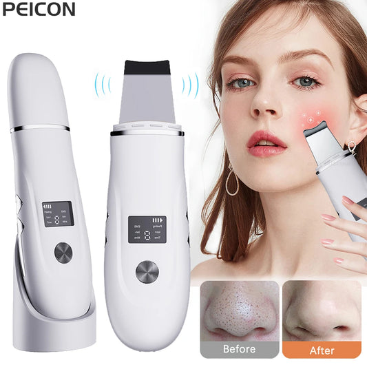 Ultrasonic Face Scrubber Facial Peeling Skin Scrubber Deep Facial Cleaning Spatula Acne Pore Ultrasonic Scrubber Facial Cleanser Peaceful Pleasures Health and Wellness