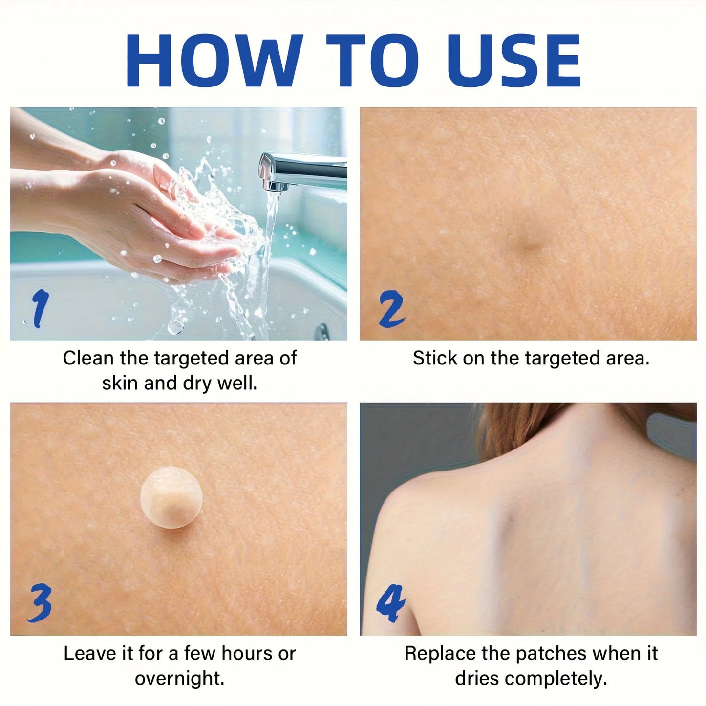144-Piece Hydrocolloid Acne Patches – Alcohol-Free Blemish Stickers