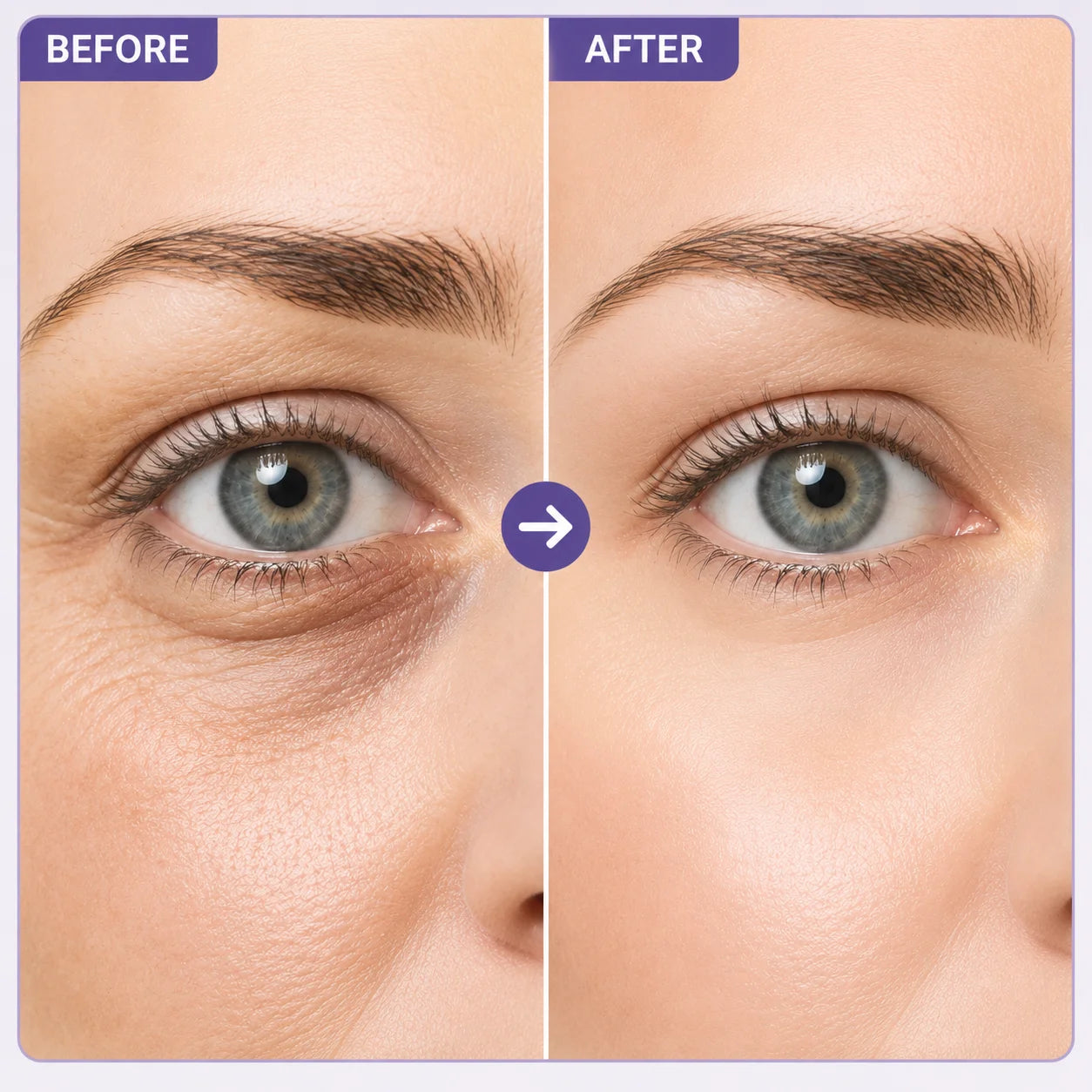 SAUVASINE Instant Lift Eye Gel | Under Eye Brightener & Hydrator